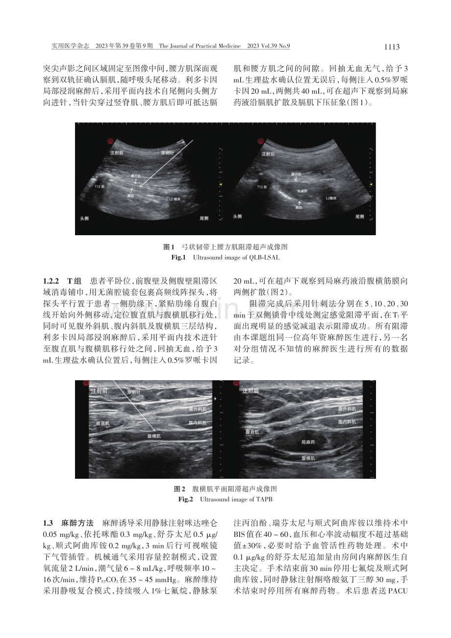 弓状韧带上腰方肌阻滞与肋下...后疼痛与恢复质量影响的比较_茆烨.pdf_第3页