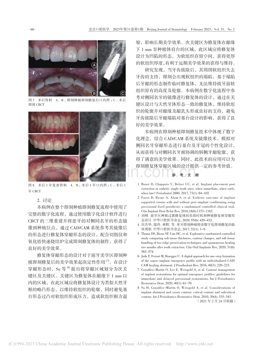 镜像技术在前牙美学区即刻种...刻修复中的应用-附1例报道_袁鼎翔.pdf_第3页