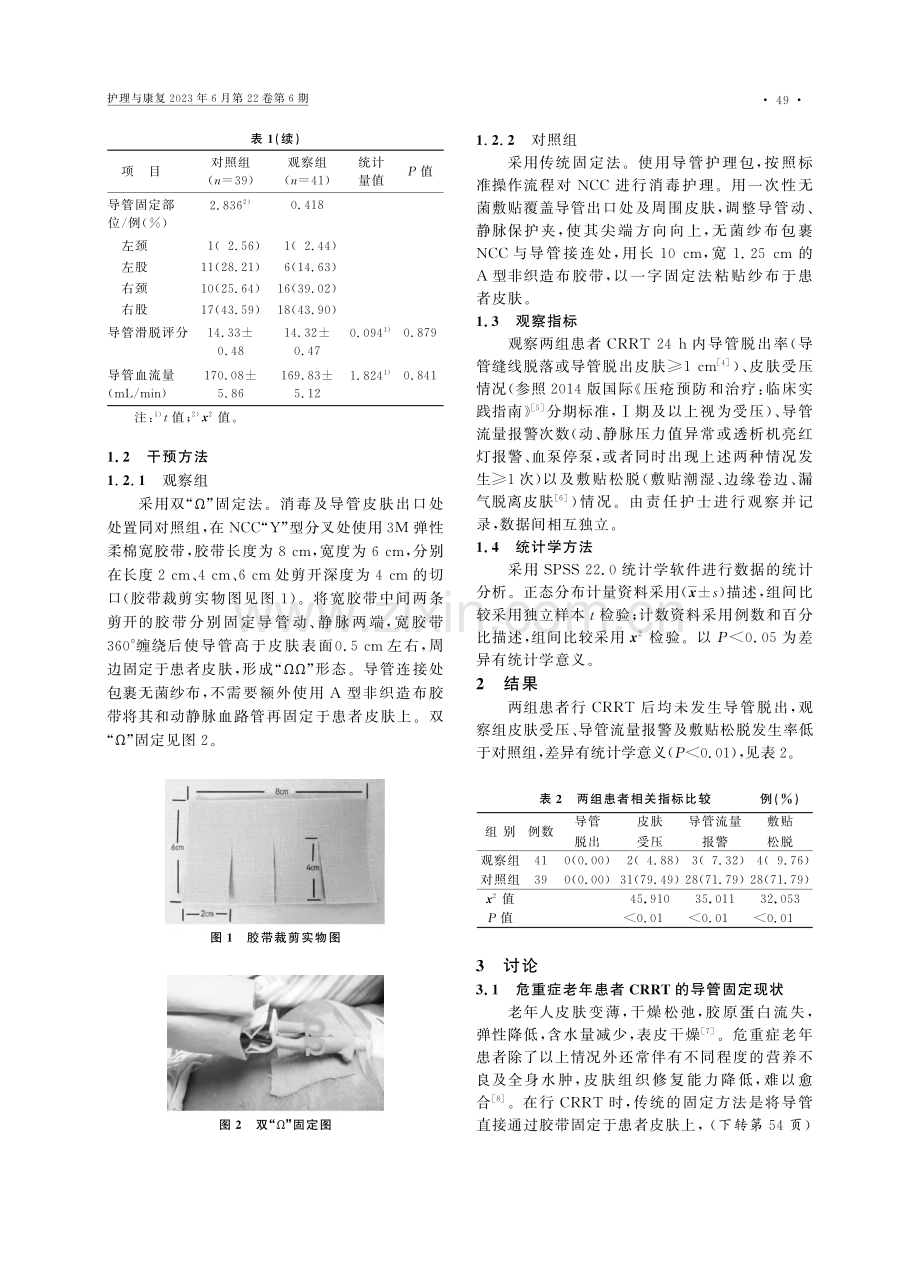 静脉导管双“Ω”固定法在危...症老年患者CRRT中的应用_缪正波.pdf_第2页