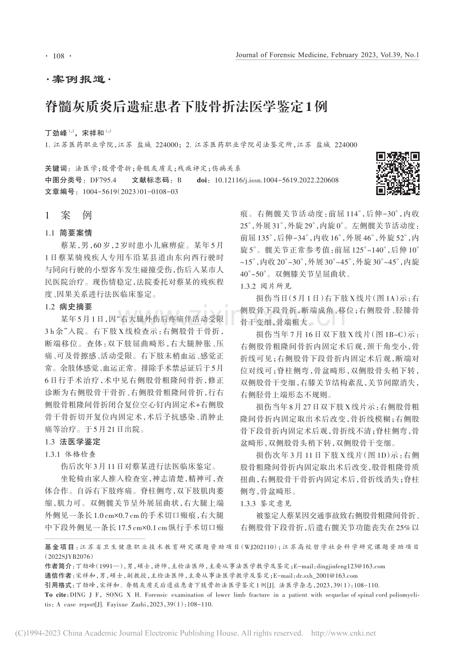 脊髓灰质炎后遗症患者下肢骨折法医学鉴定1例_丁劲峰.pdf_第1页