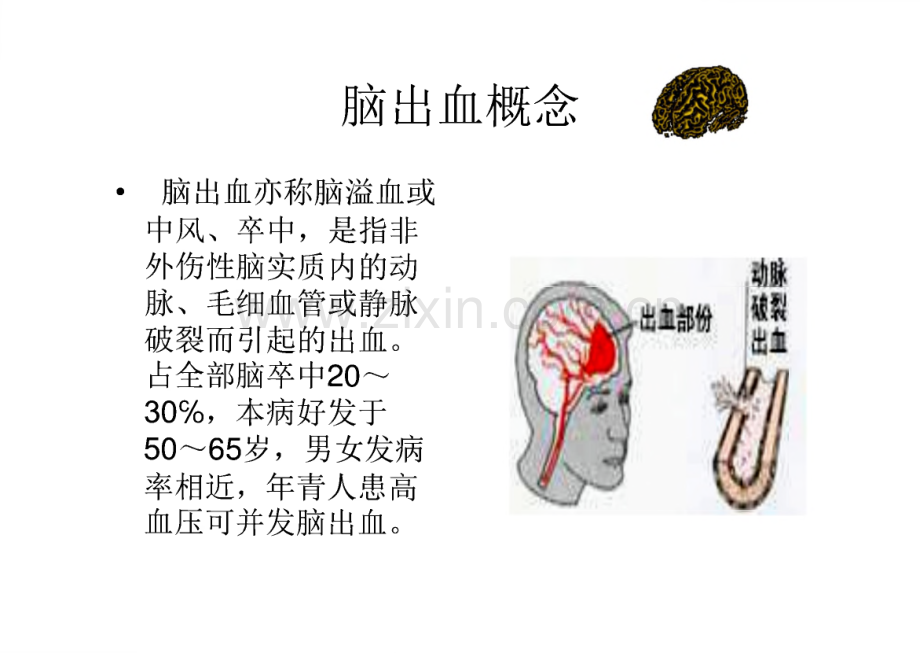 护理查房脑出血护理课件.pdf_第2页