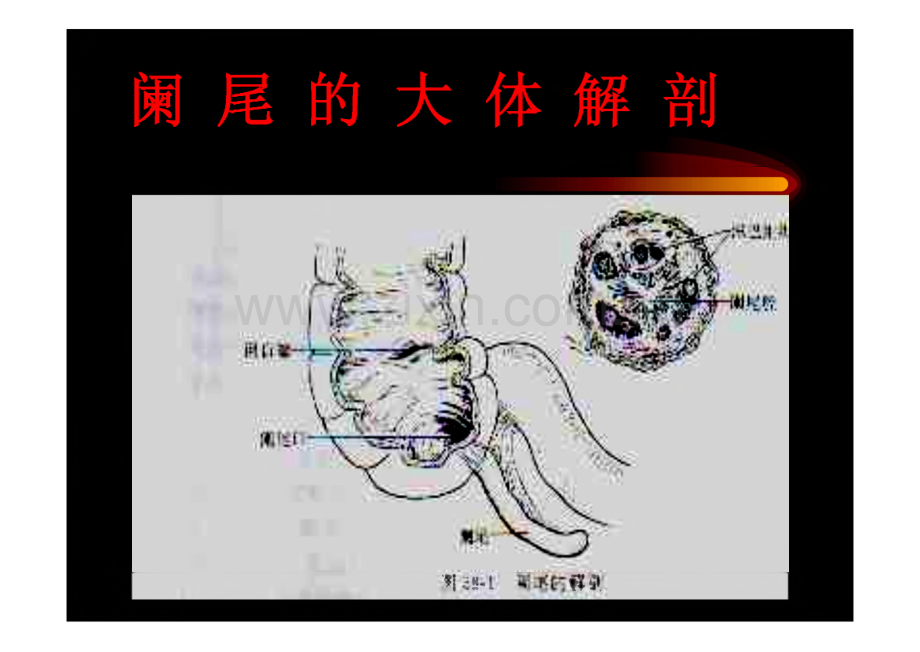 第五十章 阑尾炎、腹部教学课件.pdf_第2页