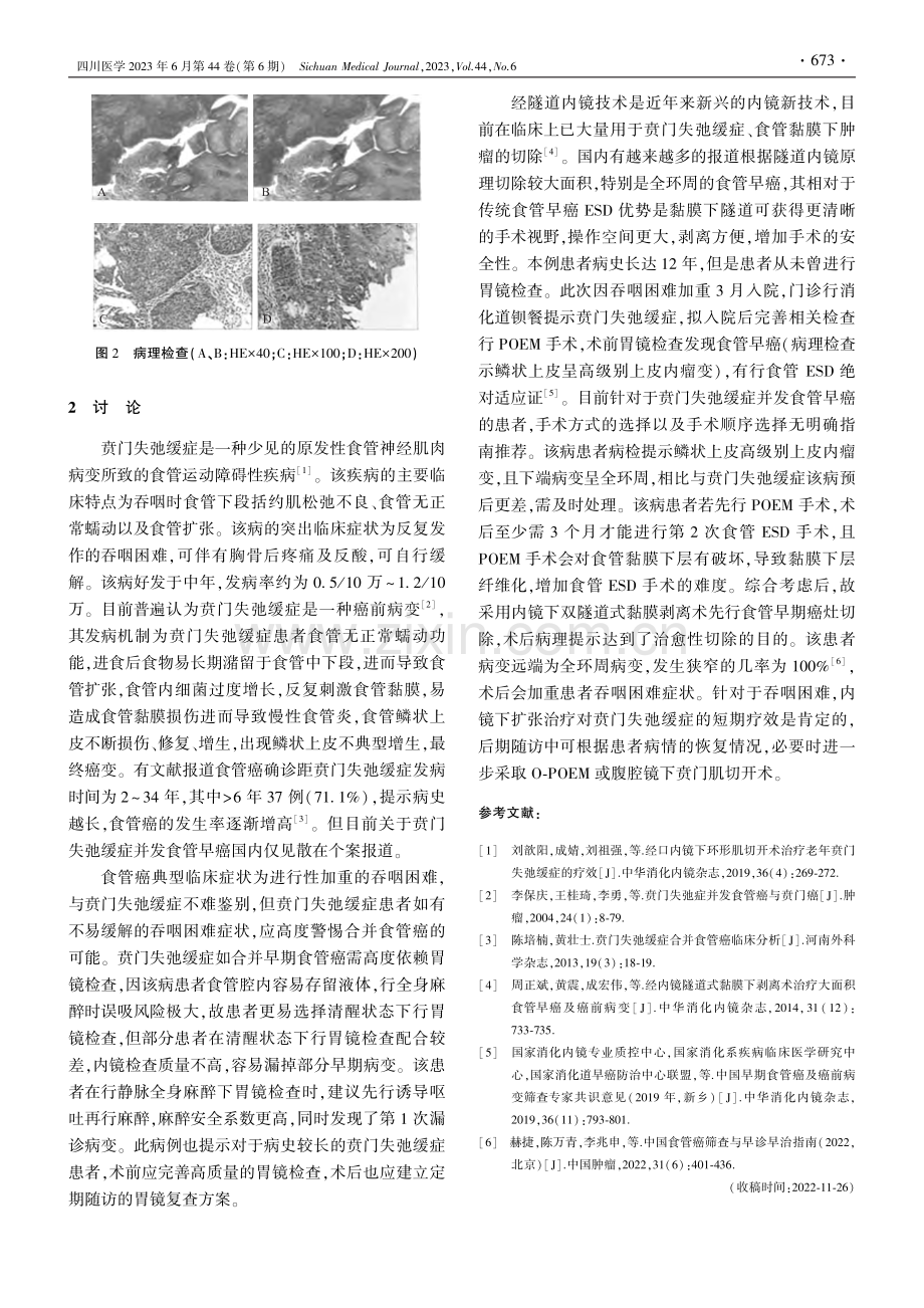 贲门失弛缓症并发食管早癌1例_黄昊.pdf_第2页