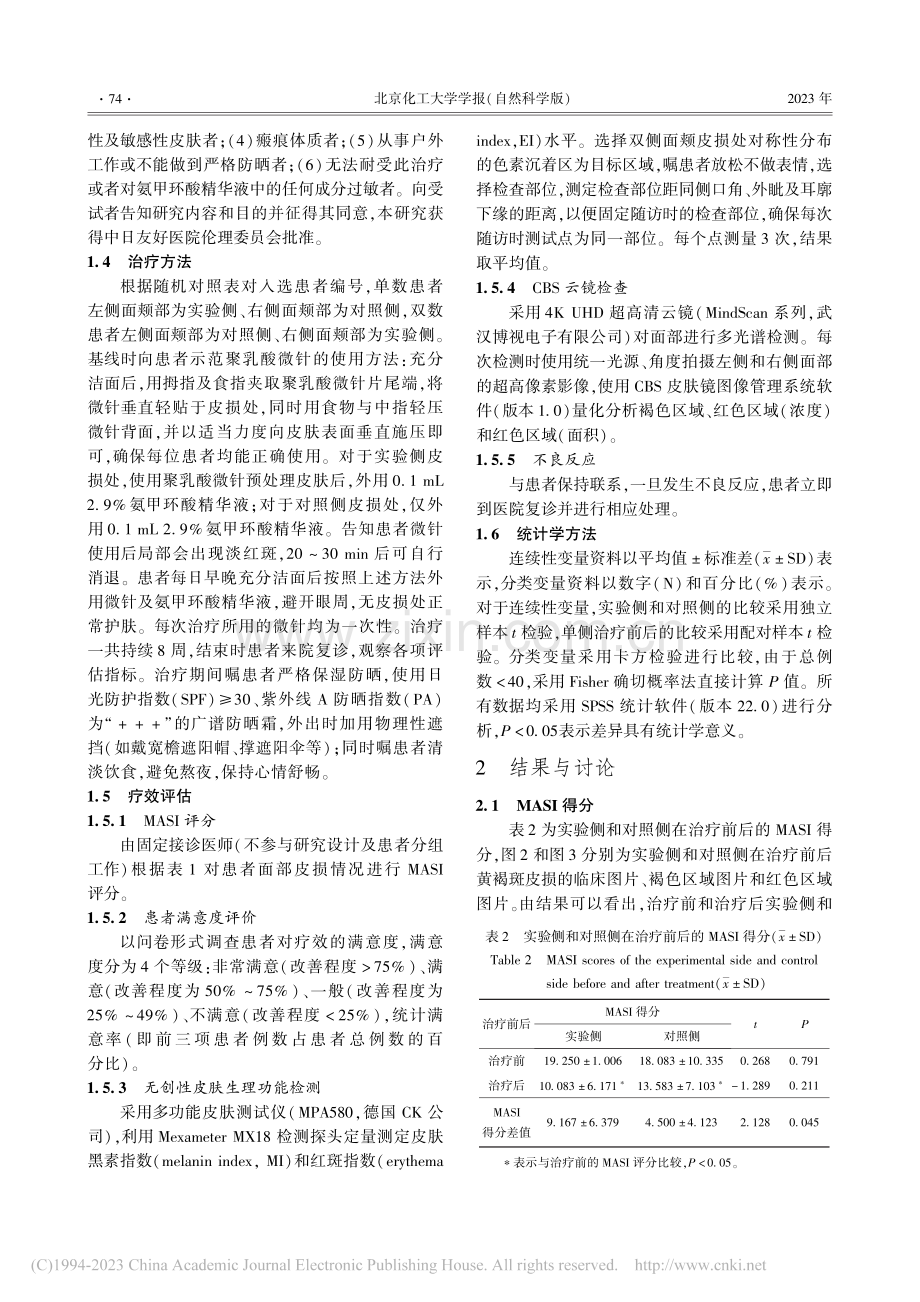 聚乳酸微针联合氨甲环酸精华液治疗黄褐斑的临床疗效观察_于瑞星.pdf_第3页