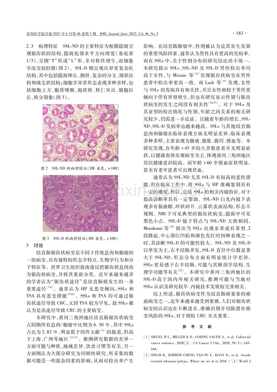 黄河三角洲地区结直肠无蒂锯齿状病变的临床病理特征.pdf_第3页