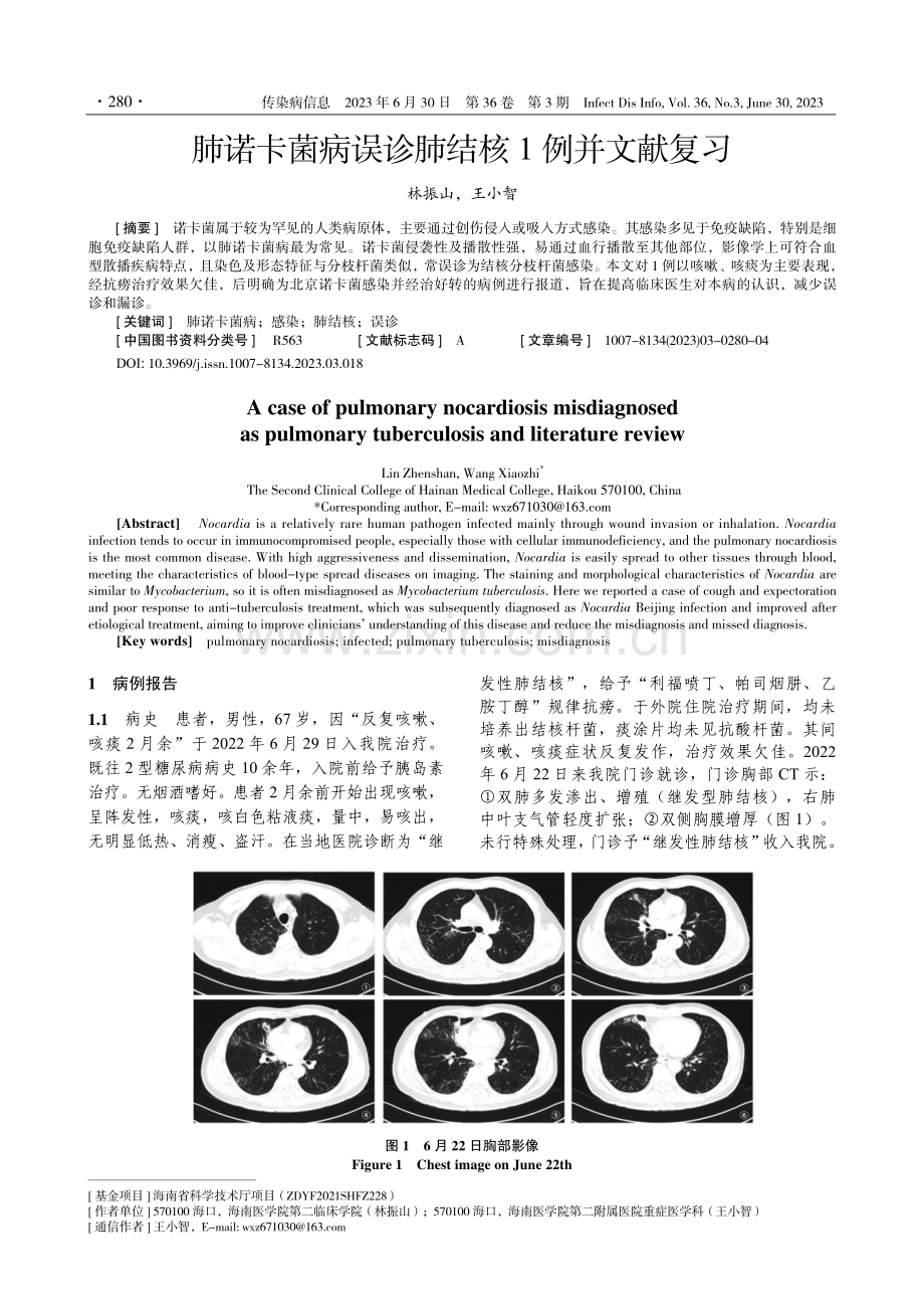 肺诺卡菌病误诊肺结核1例并文献复习.pdf_第1页