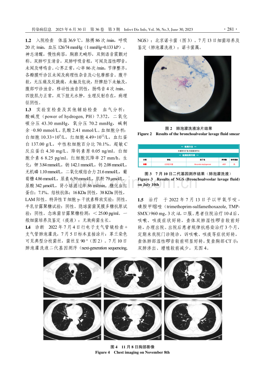 肺诺卡菌病误诊肺结核1例并文献复习.pdf_第2页