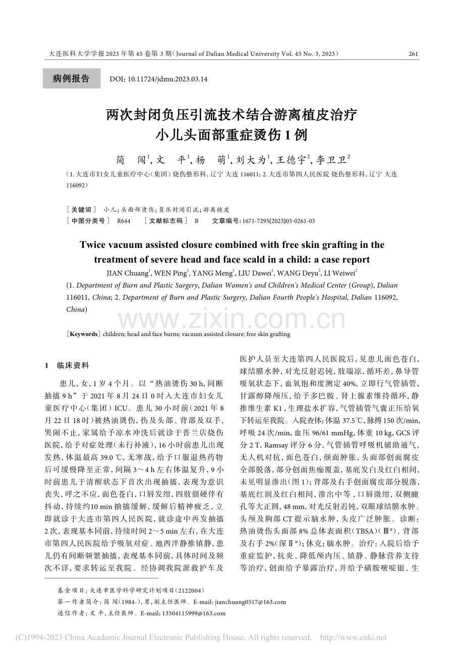 两次封闭负压引流技术结合游...治疗小儿头面部重症烫伤1例_简闯.pdf_第1页