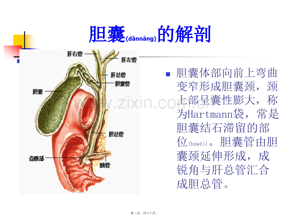 胆囊炎.ppt_第2页