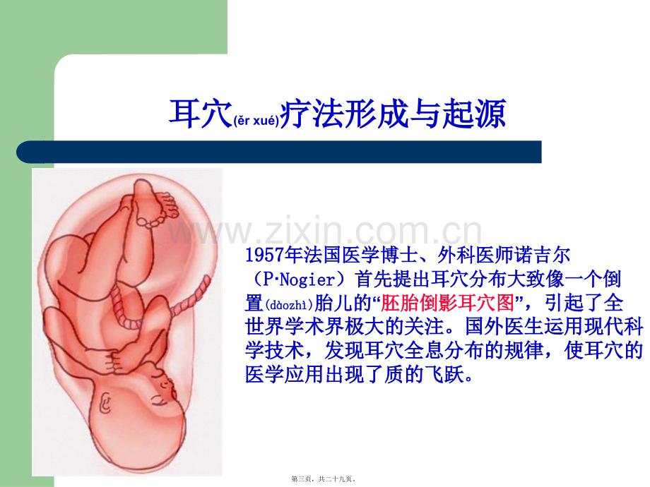 耳穴疗法.3ppt.ppt_第3页