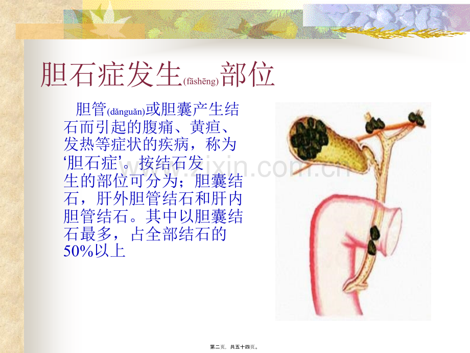 学术讨论—胆石症.ppt_第2页