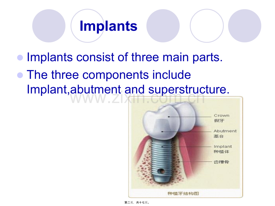 学术讨论—implant-history-and-development-口腔种植.ppt_第2页