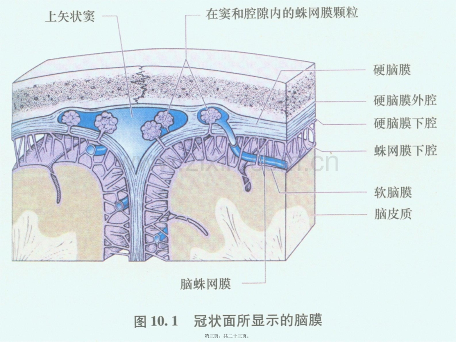 肥厚性硬脑膜炎!!.ppt_第3页