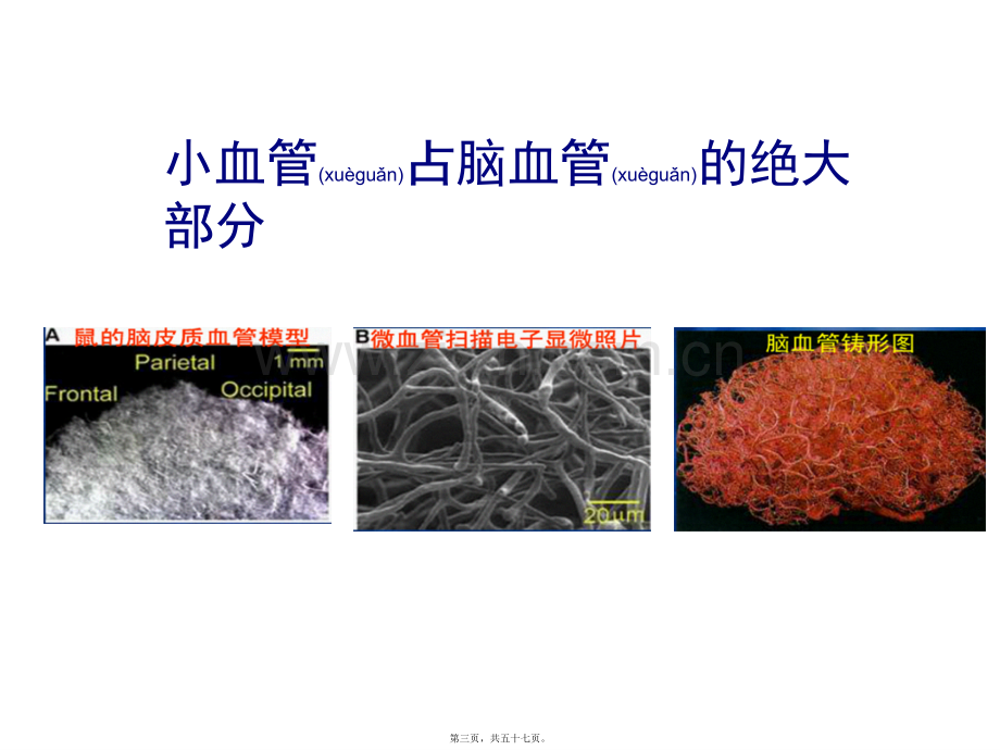 脑小血管病影像.ppt_第3页