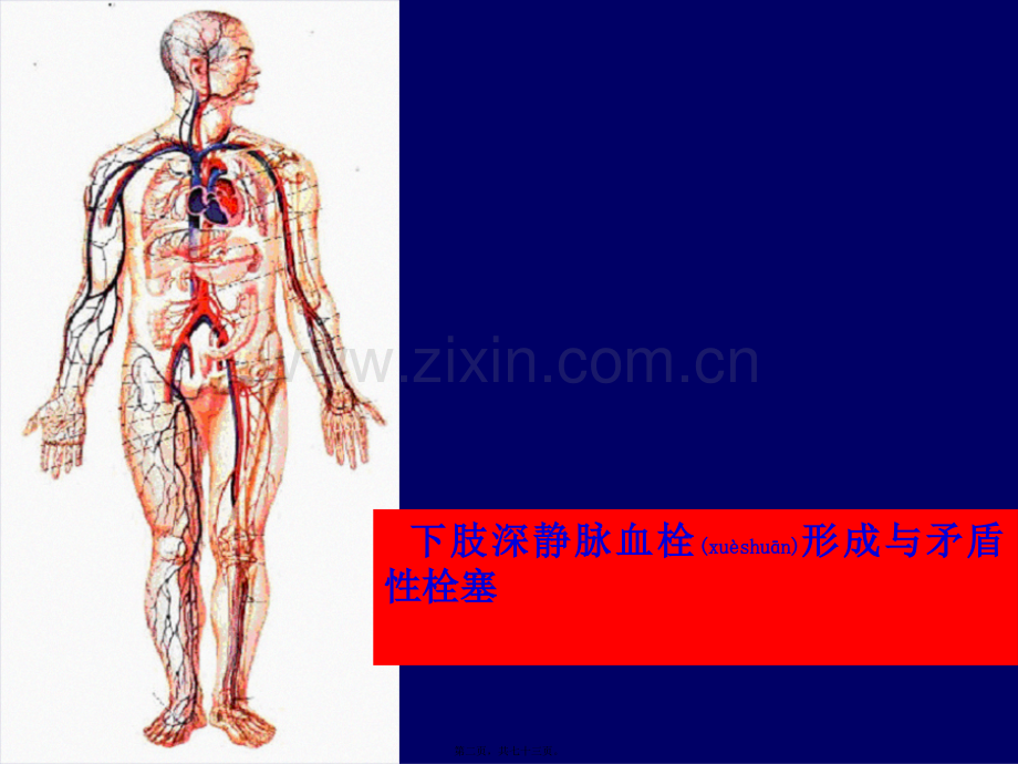 下肢静脉血栓详解.ppt_第2页