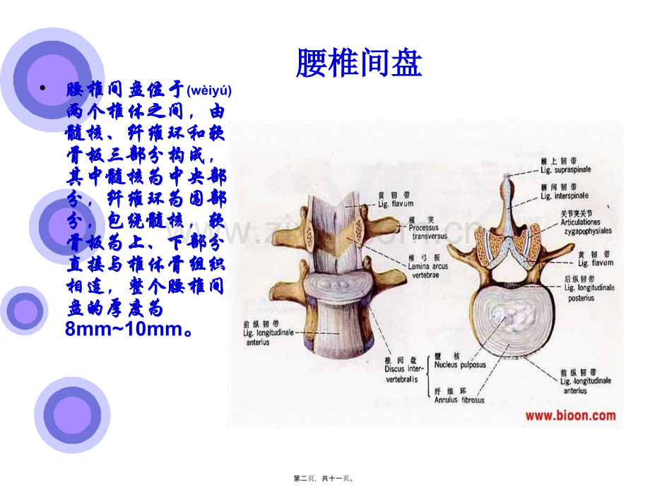 学术讨论—腰椎间盘突出症的原因与手术入口(1).ppt_第2页