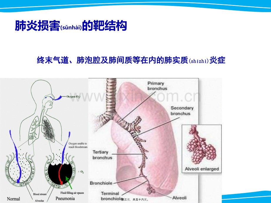 严重肺部感染诊治策略.ppt_第3页