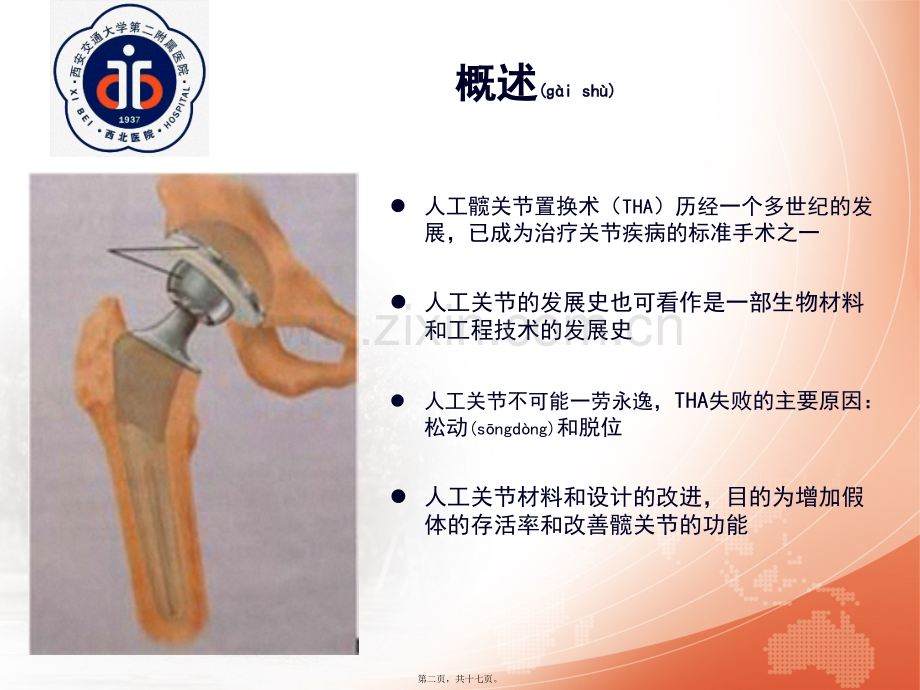 学术讨论—人工髋关节假体材料-马瑞.ppt_第2页