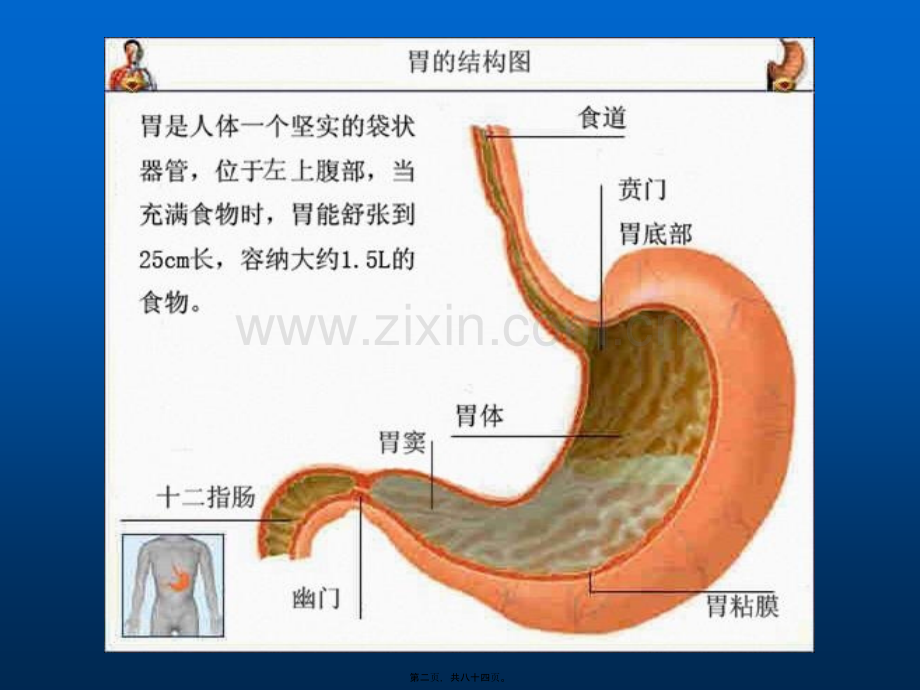 胃癌--本科教材讲课.ppt_第2页