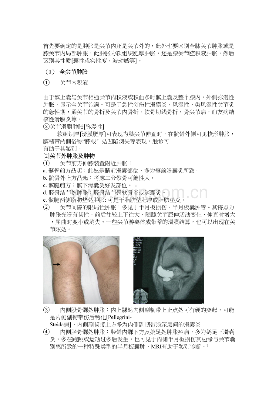 与膝关节镜手术相关疾患的膝关节检查法.docx_第3页