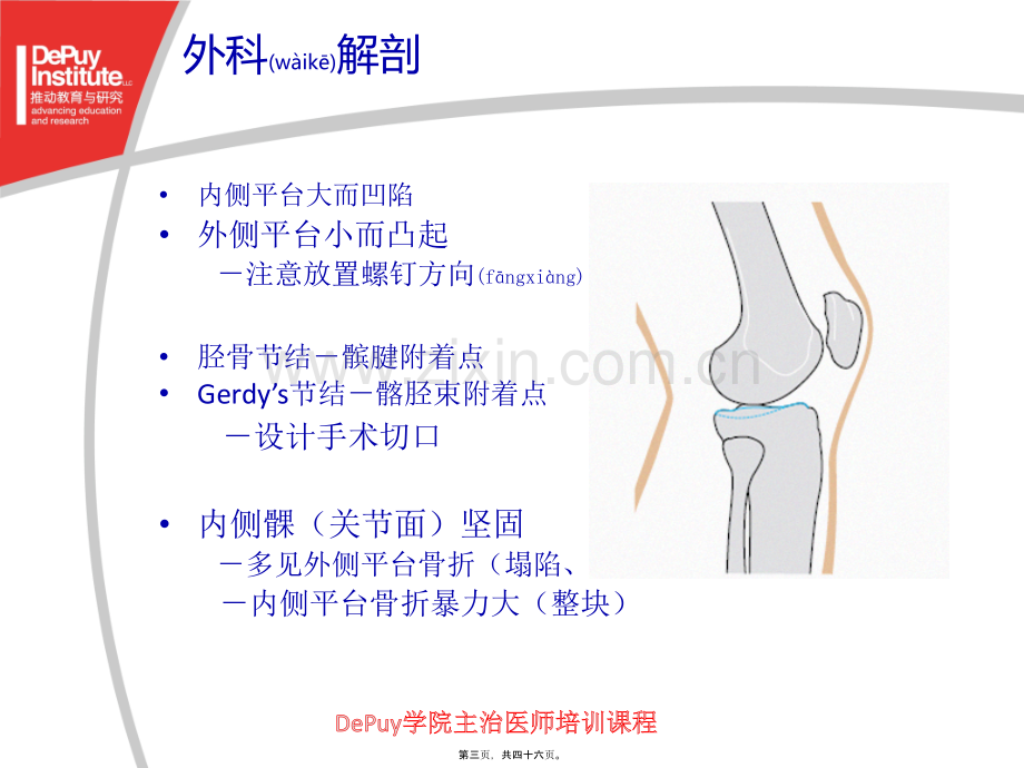 胫骨平台骨折(Depuy).ppt_第3页