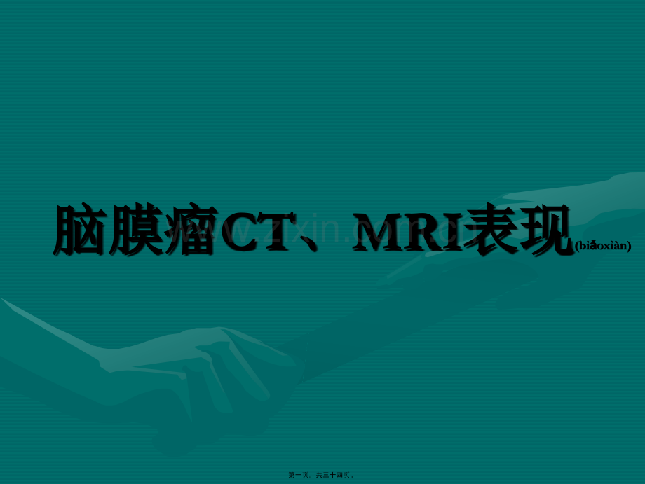 脑膜瘤CTMRI表现.ppt_第1页