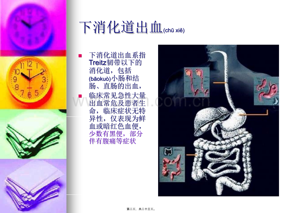 下消化道出血+腹痛.ppt_第2页