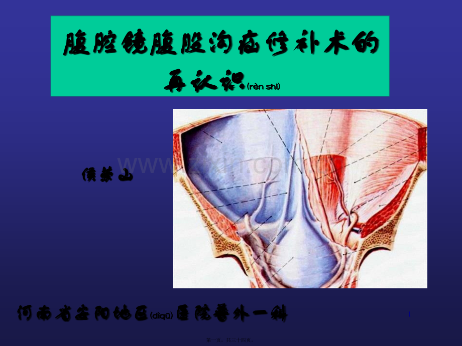 腹腔镜腹股沟疝修补术的再认识.ppt_第1页