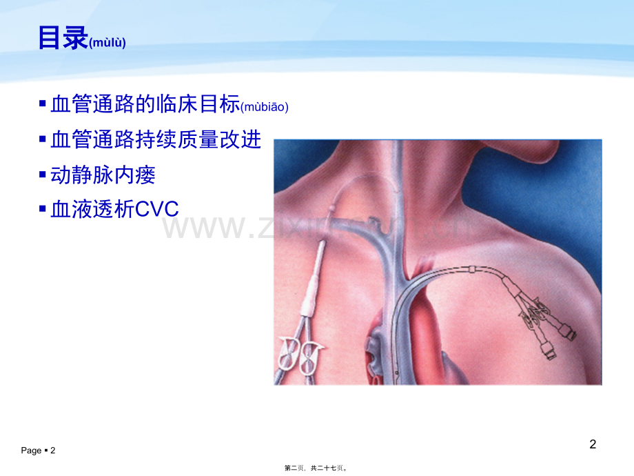 中国血液透析用血管通路专家共识资料.ppt_第2页