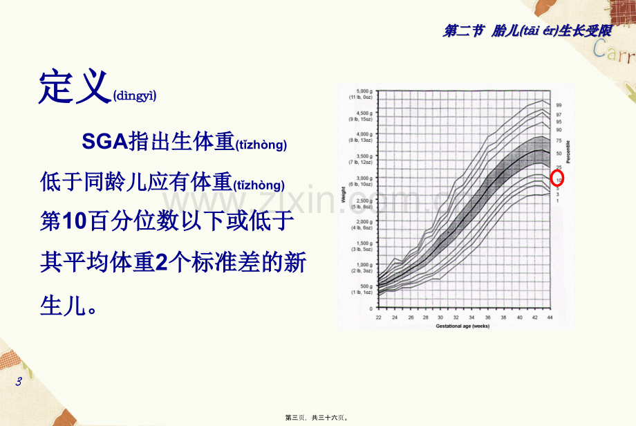 胎儿异常与多胎妊娠.ppt_第3页