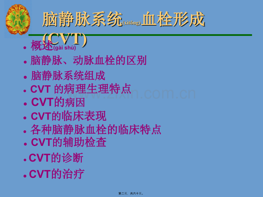 脑静脉系统血栓形成全面PPT概要.ppt_第2页