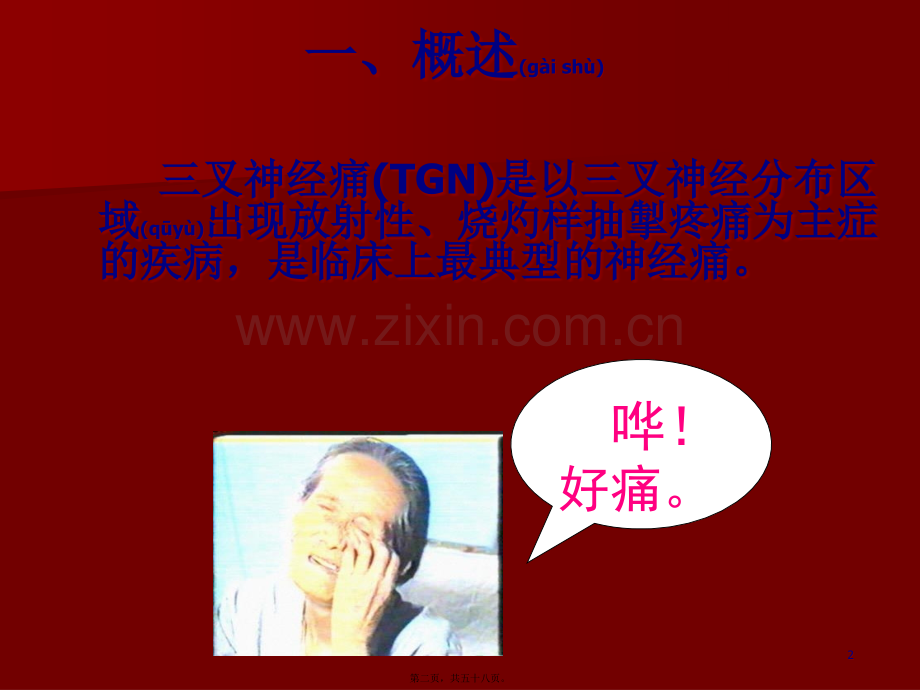 学术讨论—三叉神经痛详解.ppt_第2页