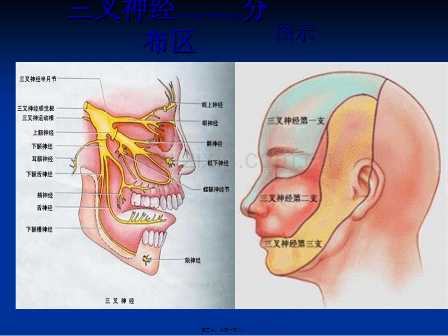 三叉神经痛(讲).ppt_第3页