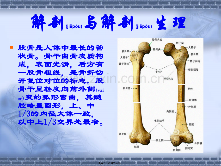 股骨干骨折.ppt_第3页