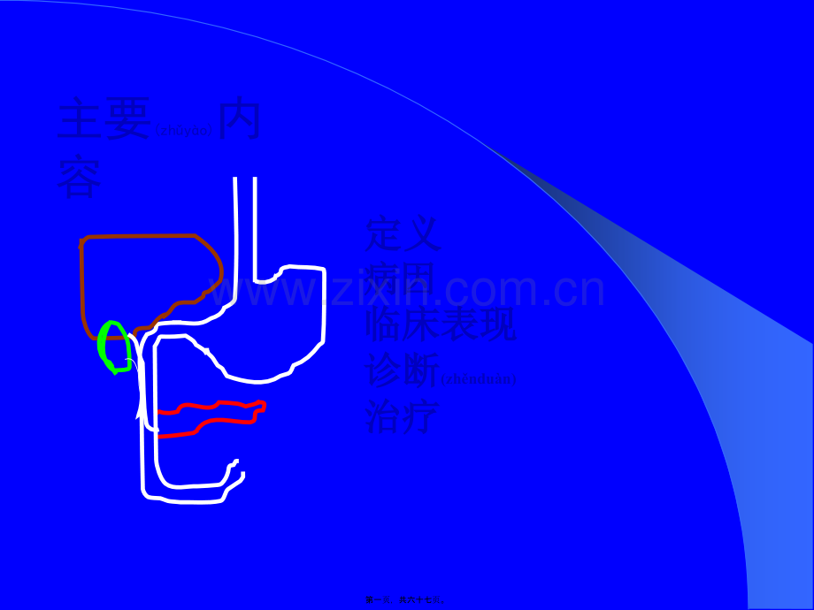 上消化道出血的处理(武希润).ppt_第1页