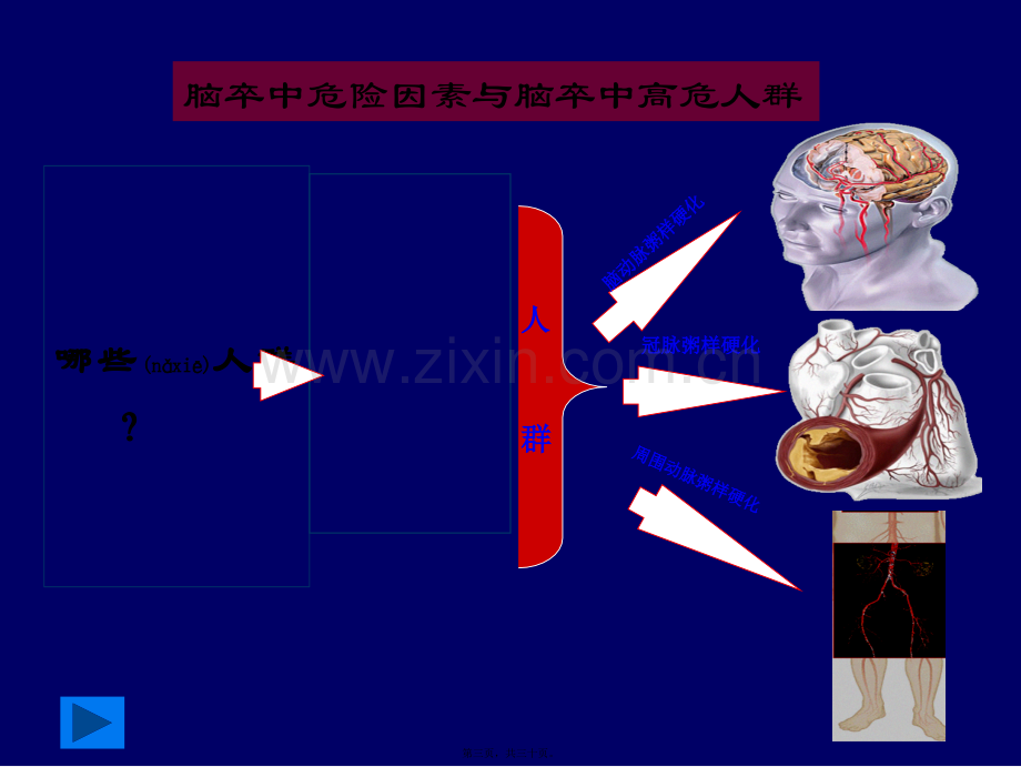 脑卒中筛查血管超声检查.ppt_第3页