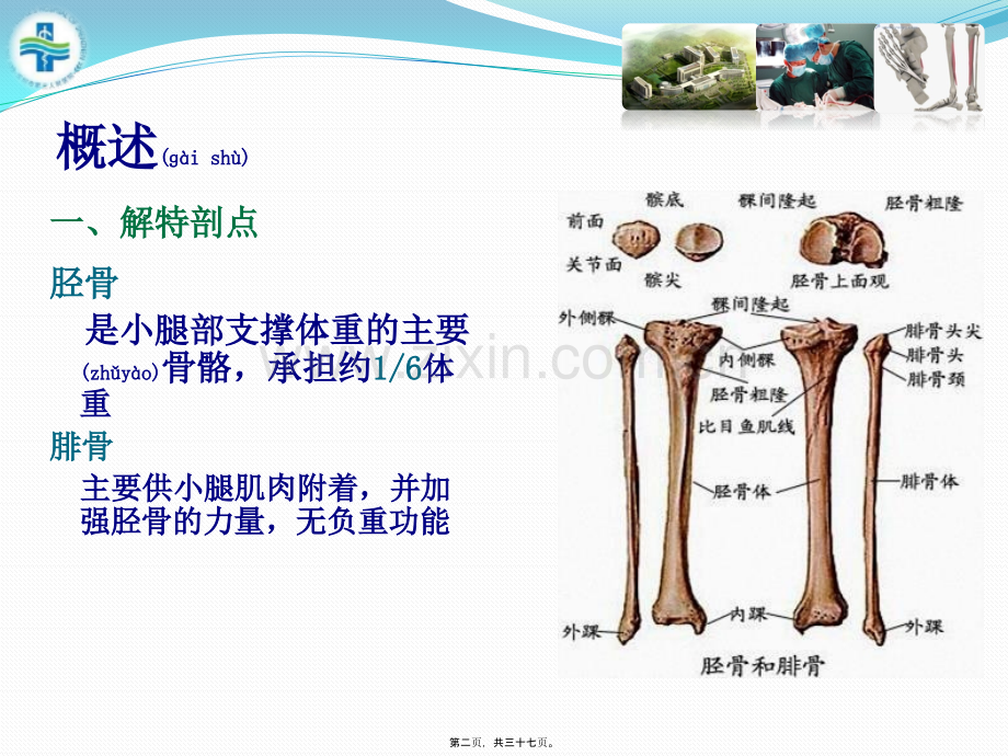 胫腓骨骨折患者查房(1).pptx_第2页