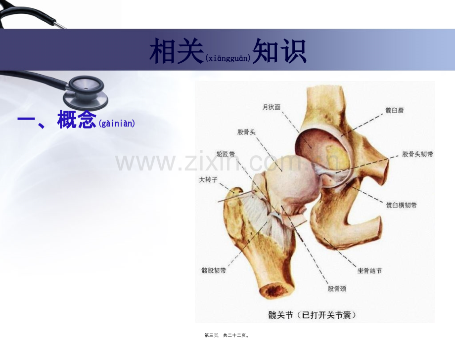 人工全髋关节置换术.ppt_第3页