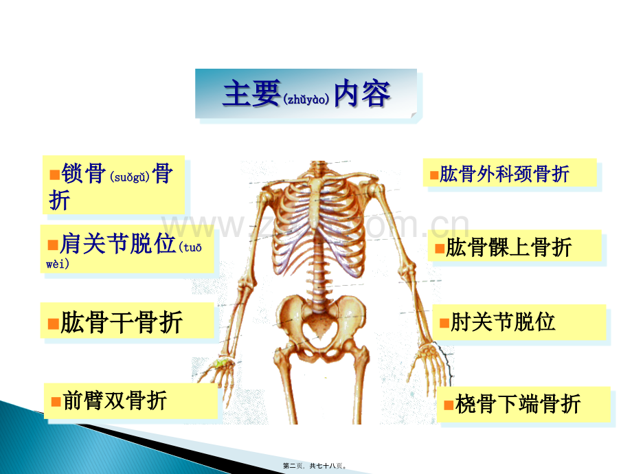 上肢骨折.ppt_第2页