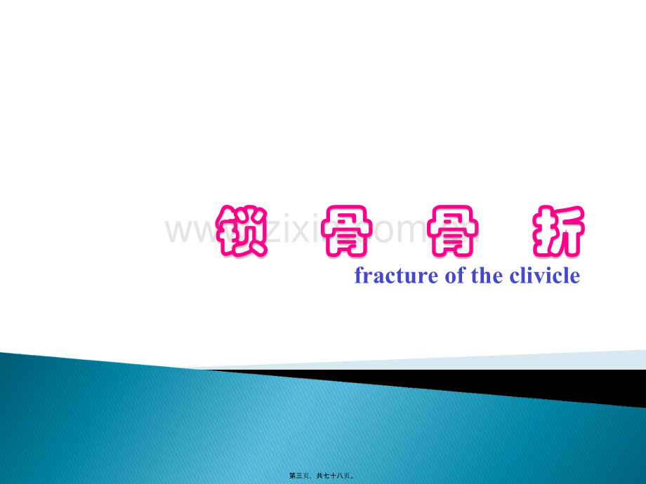 上肢骨折.ppt_第3页