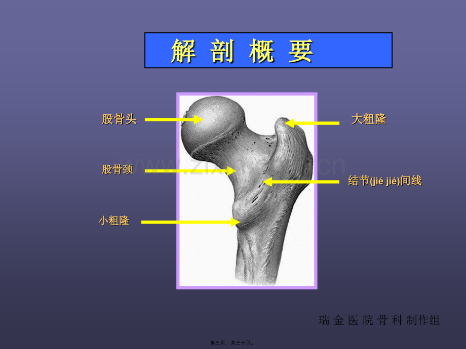 学术讨论—股骨颈骨折-PPT.ppt_第3页