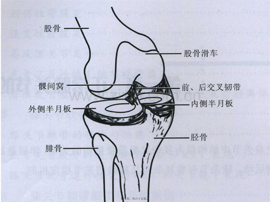 膝关节MRI读片.ppt_第3页