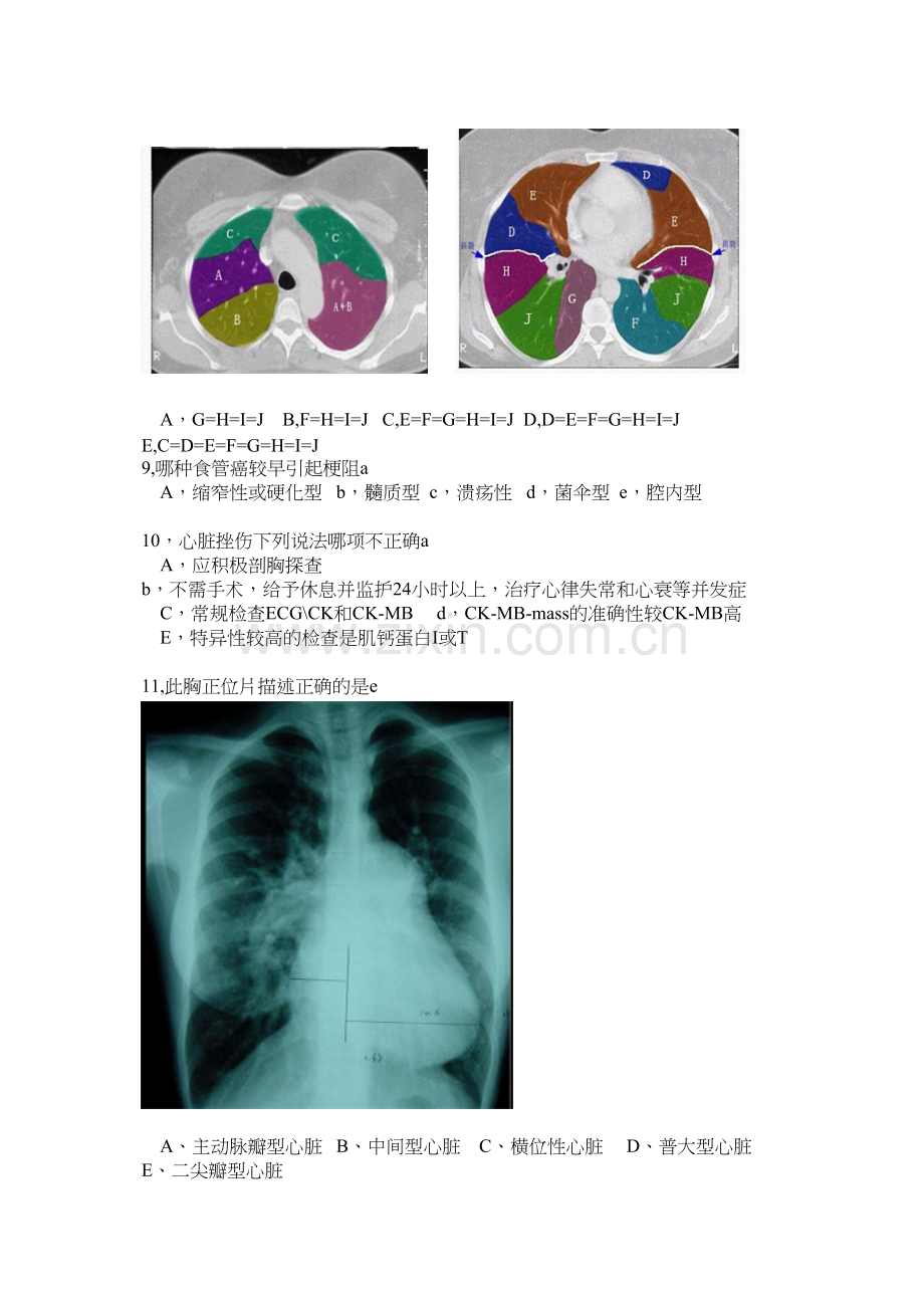 胸外科单选题1.docx_第2页