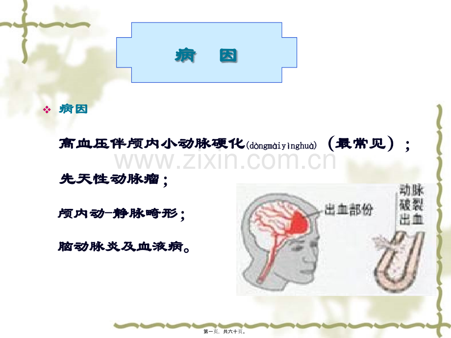 脑出血讲课.ppt_第1页