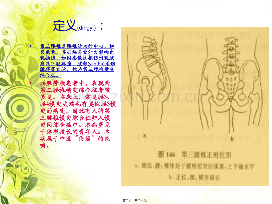 腰3横突综合症..ppt_第2页