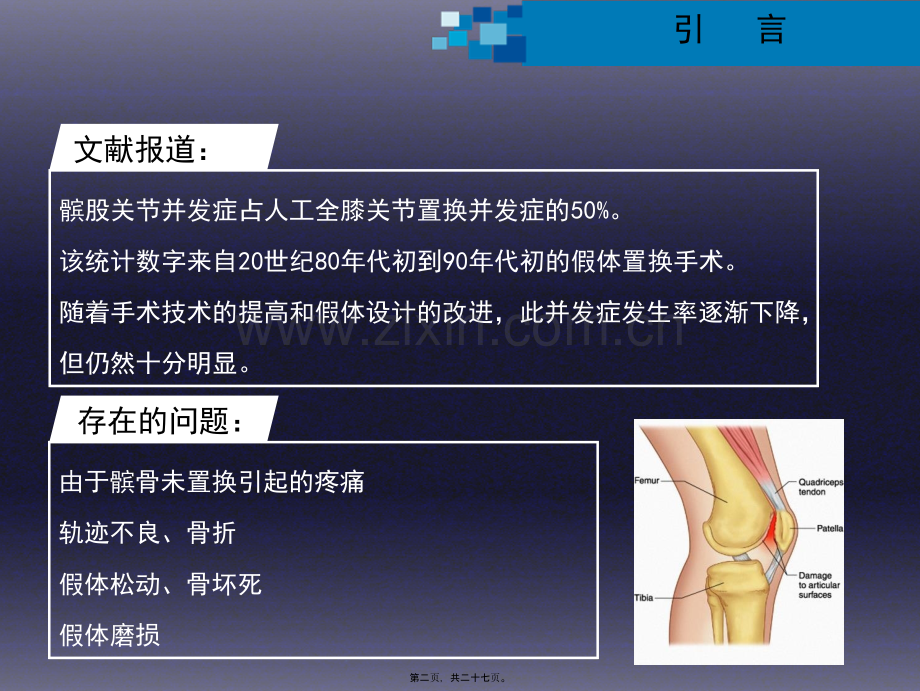 学术讨论—与全膝关节置换相关的髌股关节并发症...ppt_第2页