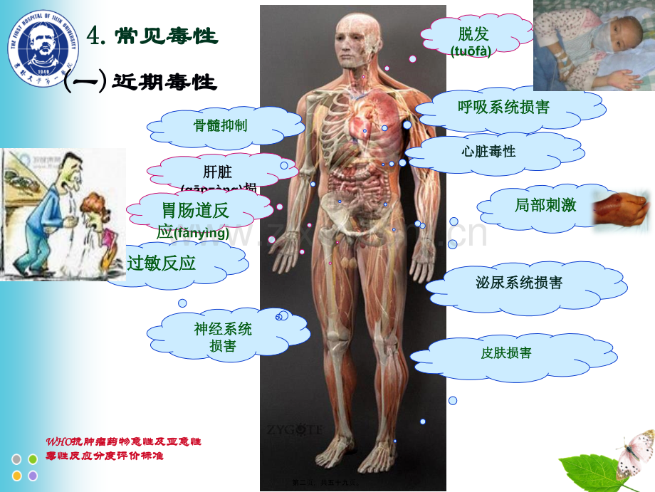 ZCZ-化疗常见毒副反应及处理.ppt_第2页