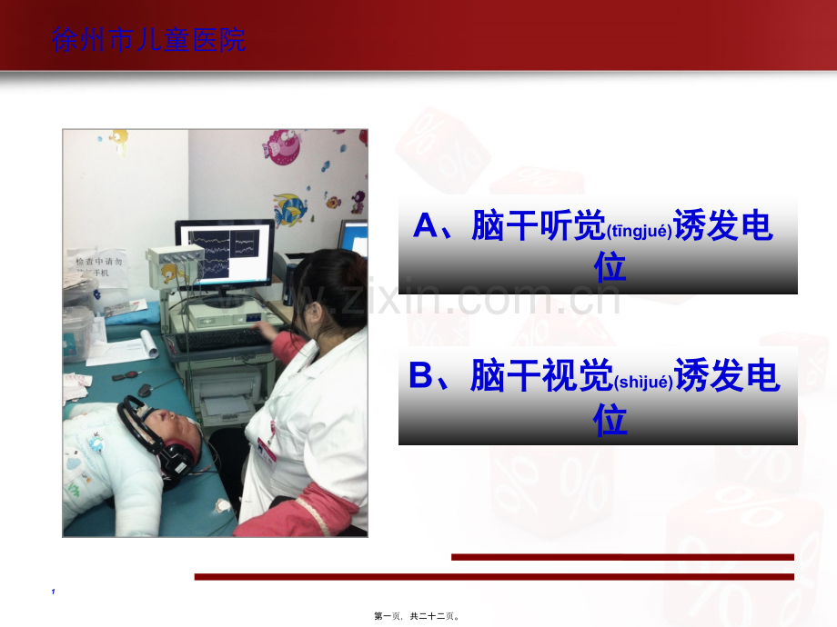 脑干诱发电位—刘军.ppt_第1页