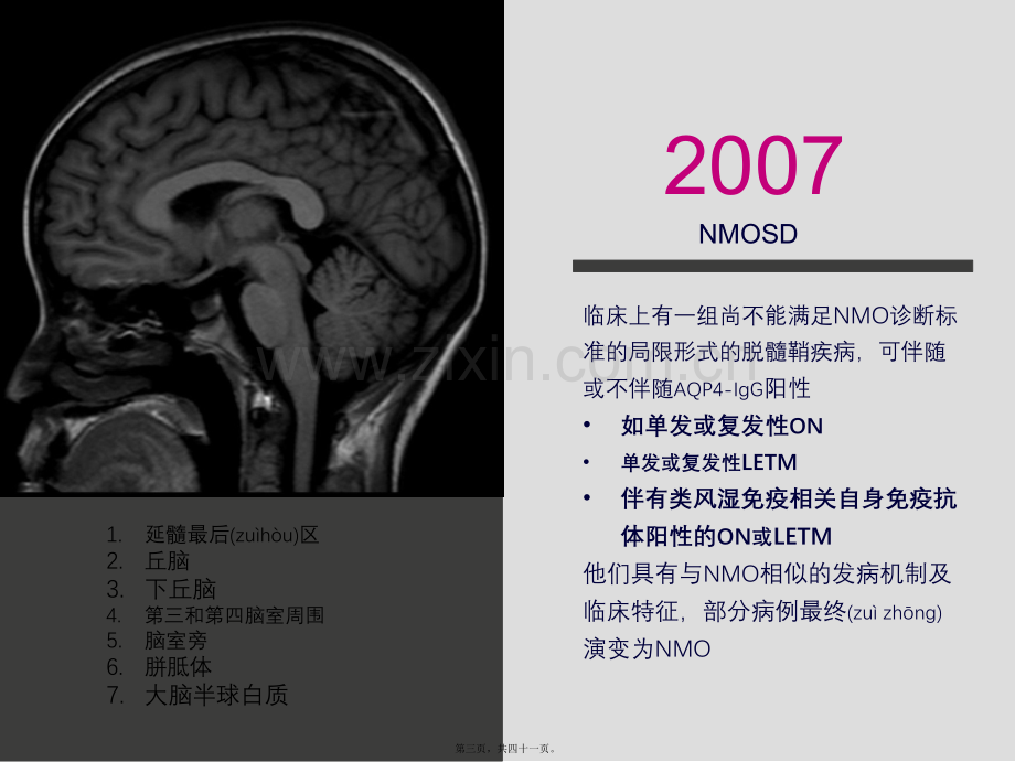 中国NMOSD诊治指南2015.ppt_第3页