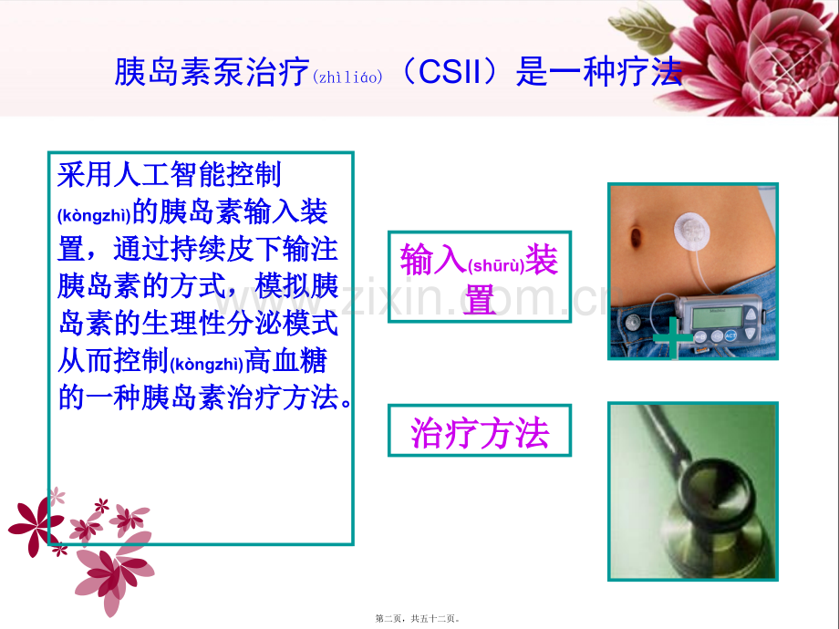 胰岛素泵的使用.ppt_第2页